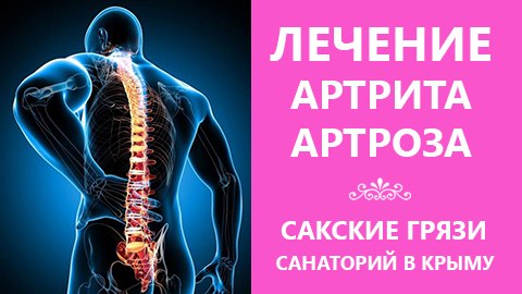 Артроз лечение грязями Артроз лечение грязями