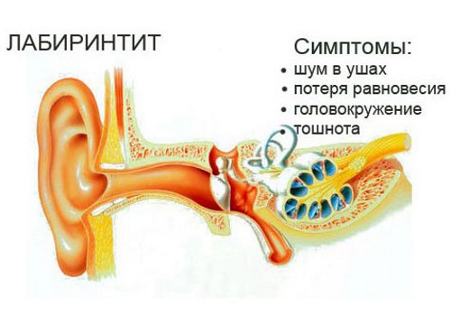 Лечить шум в ушах в домашних условиях 882