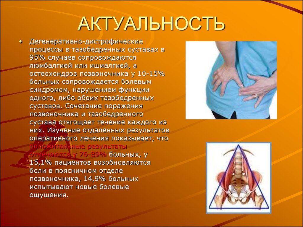 Дифференциальный диагноз ревматоидного артрита - МедОтвет Грыжа шейного отдела позвоночника: симптомы