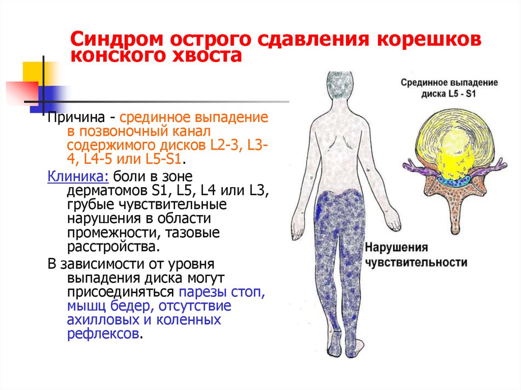Где и по какой цене можно приобрести препарат АСД Вреден ли частый массаж простаты? - Здоровая простата
