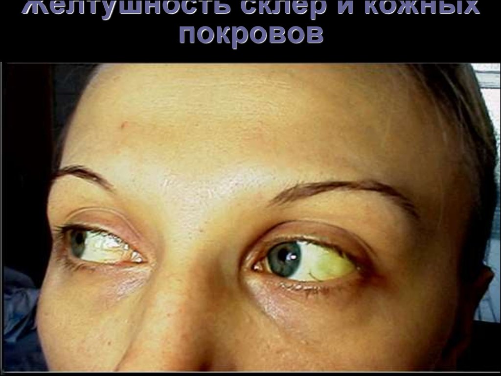 От чего пожелтела кожа на лице От чего пожелтела кожа на лице
