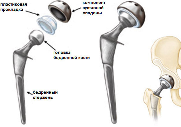 Кости болеет как это будем лечить Кости болеет как это будем лечить