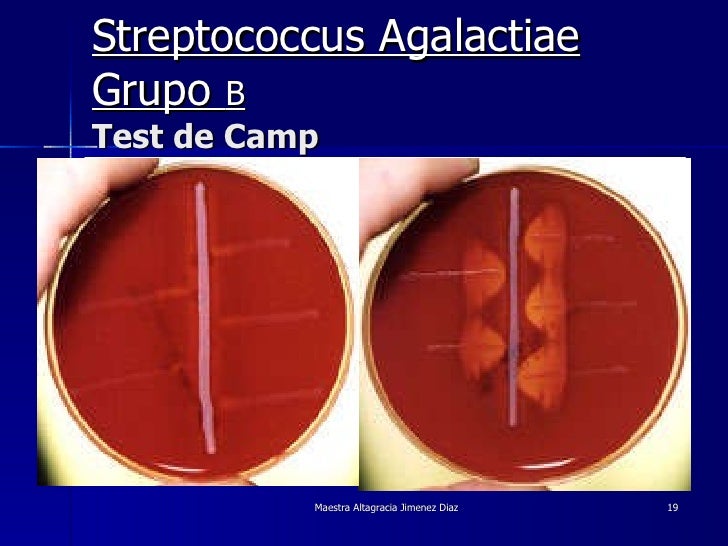 Streptococcus agalactiae у мужчин как лечить Streptococcus agalactiae у мужчин как лечить