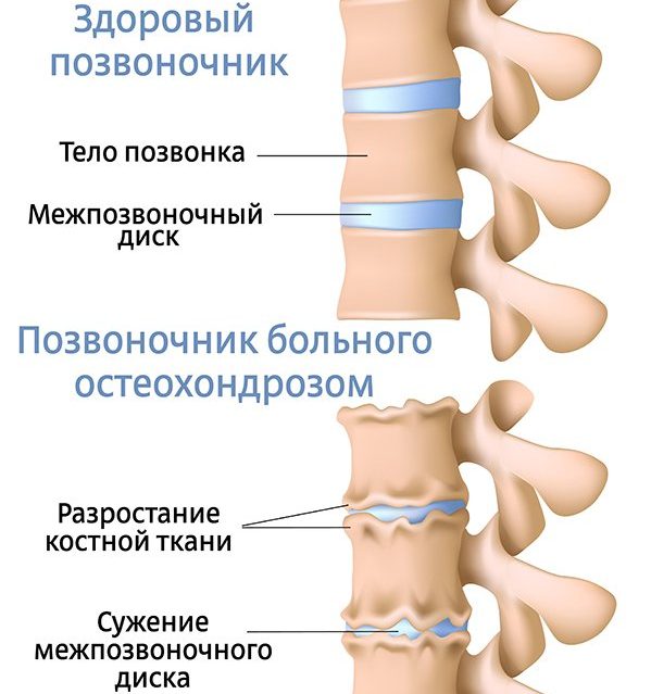 Сыпь аллергия у ребенка как лечить комаровский Сыпь аллергия у ребенка как лечить комаровский